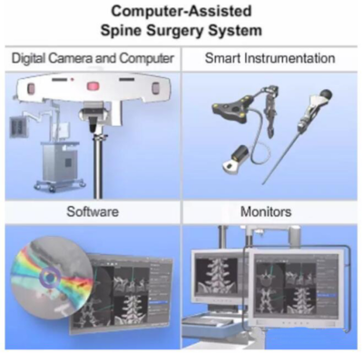 計算機輔助脊柱外科手術(Computer-assisted spine surgery)